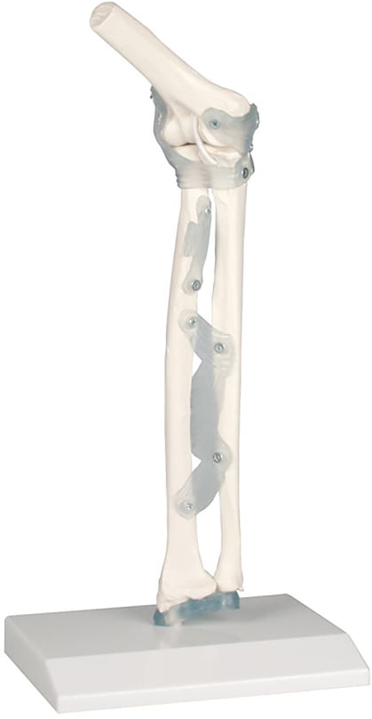Erler-Zimmer Elbow Joint with Ligaments