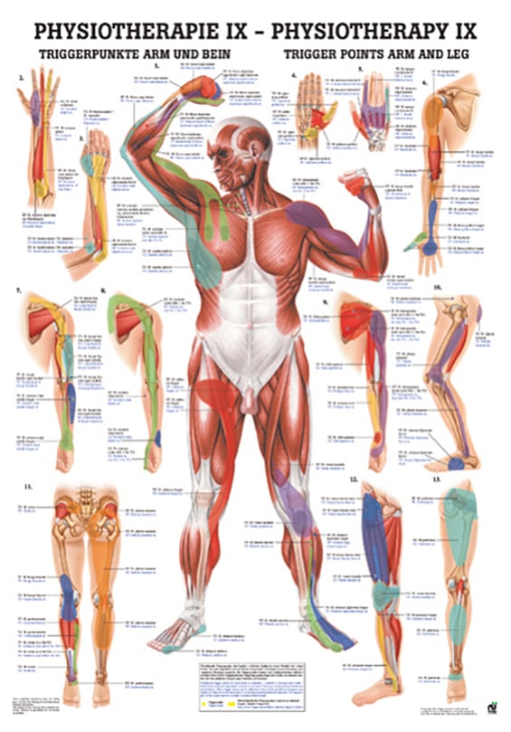 Poster - Trigger Points for Arm and Leg