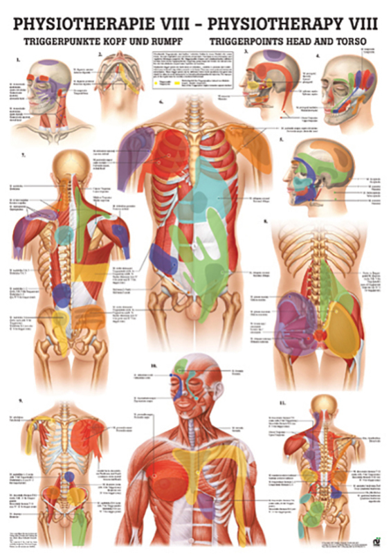 Poster - Trigger Points Head and Torso