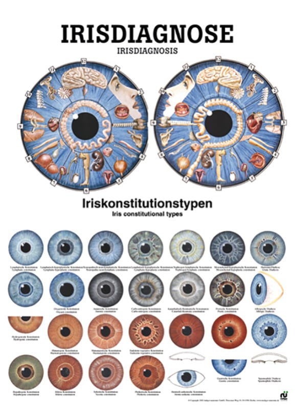 Poster - Iris Diagnosis