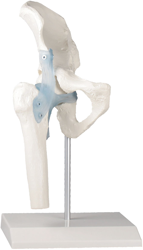 Erler-Zimmer Hip Joint with Ligaments