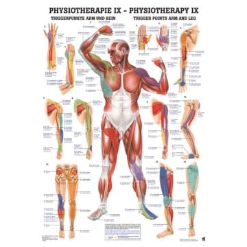 Poster - Trigger Points for Arm and Leg