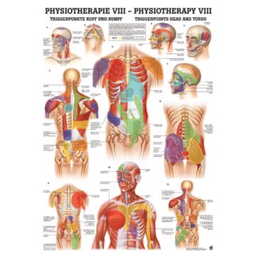 Poster - Trigger Points Head and Torso