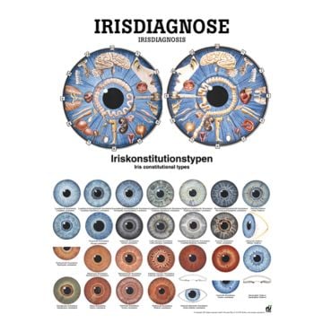 Poster - Iris Diagnosis