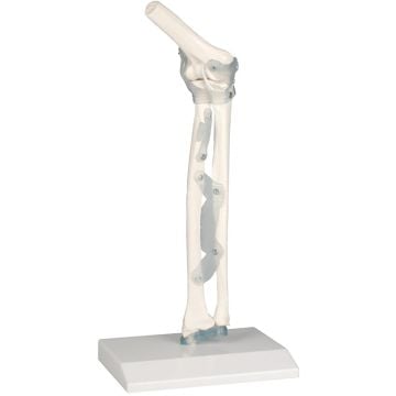 Erler-Zimmer Elbow Joint with Ligaments