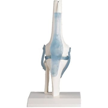 Erler-Zimmer Knee Joint with Ligaments