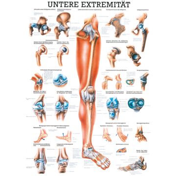 Poster - Lower Extremity