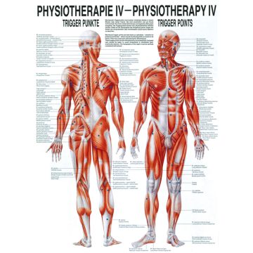 Poster - Trigger Points