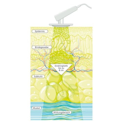 PHYSIOMED® DEEP OSCILLATION® Personal Basic