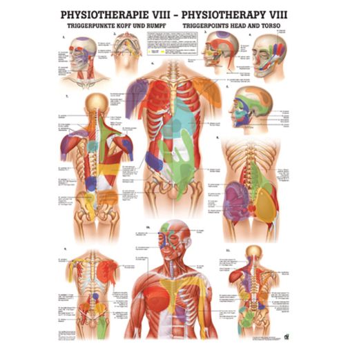 Poster - Trigger Points Head and Torso