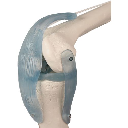 Erler-Zimmer Knee Joint with Ligaments