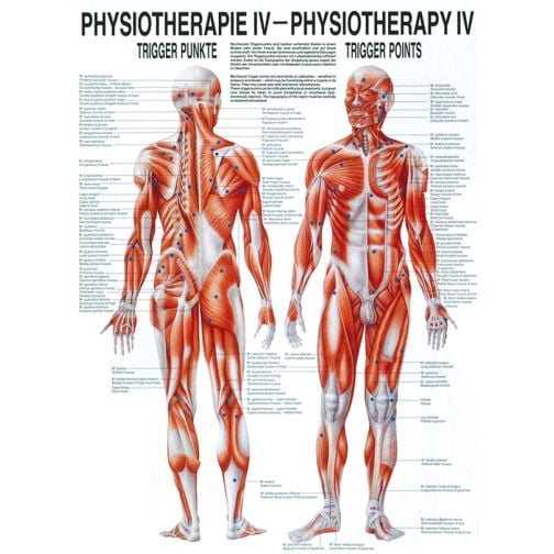 Poster - Trigger Points