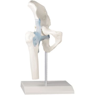 Erler-Zimmer Hip Joint with Ligaments