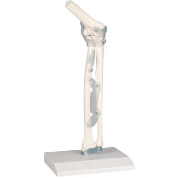 Erler-Zimmer Elbow Joint with Ligaments