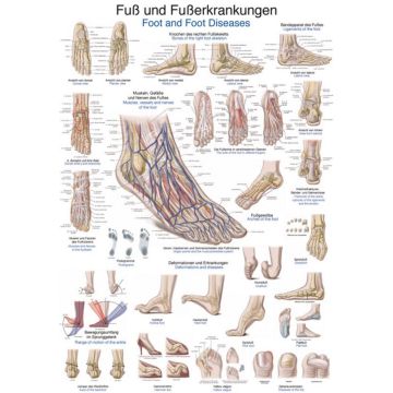 Poster - Foot and Foot Disorders