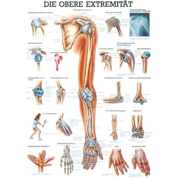 Educational Chart - Upper Extremity