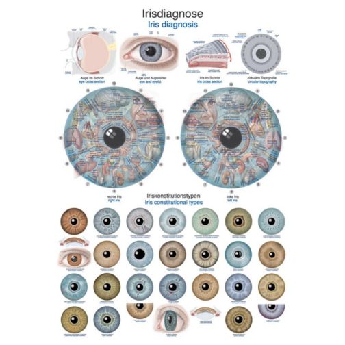 Chart - Iris Diagnosis