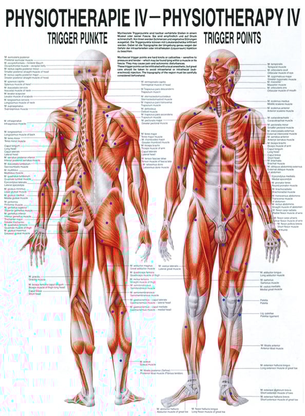 Poster - Trigger Points
