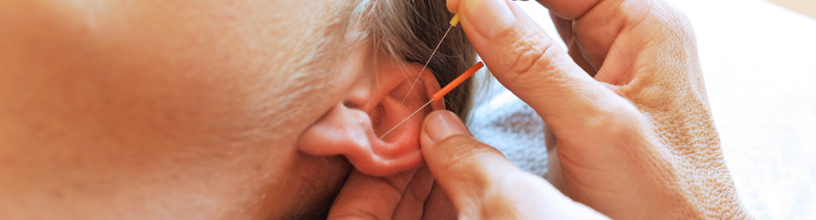 Acupuncture Accessories