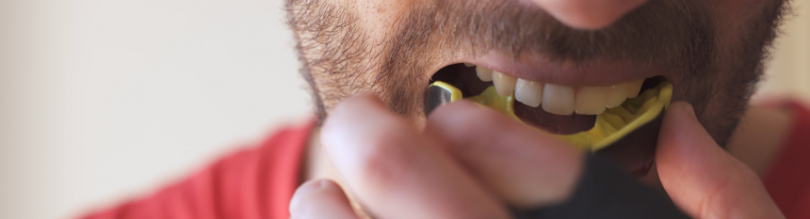 Mouthguard